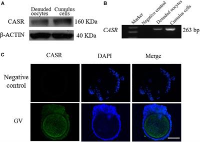 The Calcium-Sensing Receptor Is Involved in Follicle-Stimulating Hormone-Induced Cumulus Expansion in in vitro Cultured Porcine Cumulus-Oocyte Complexes